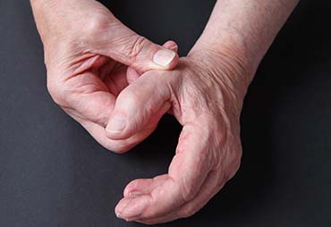 Man holding his thumb in pain due to basal joint arthritis
